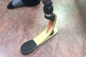 Ankle Foot Prosthetics Vegas