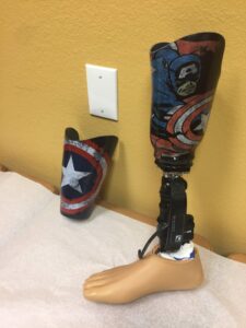 Microprocessor Feet & Knees In Las Vegas | Evolve Prosthetics & Orthotics