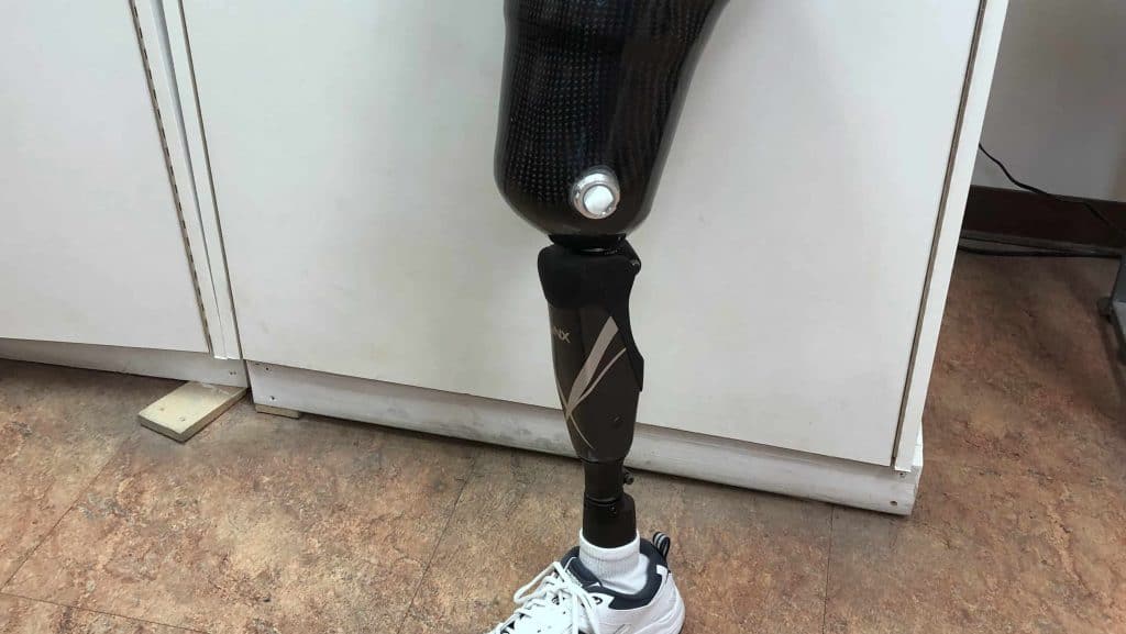 Prosthetic Knee Vegas