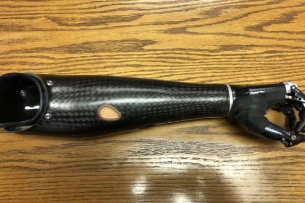 Bionic Limbs Vs. Traditional Prosthetics: Which Is Right For You?