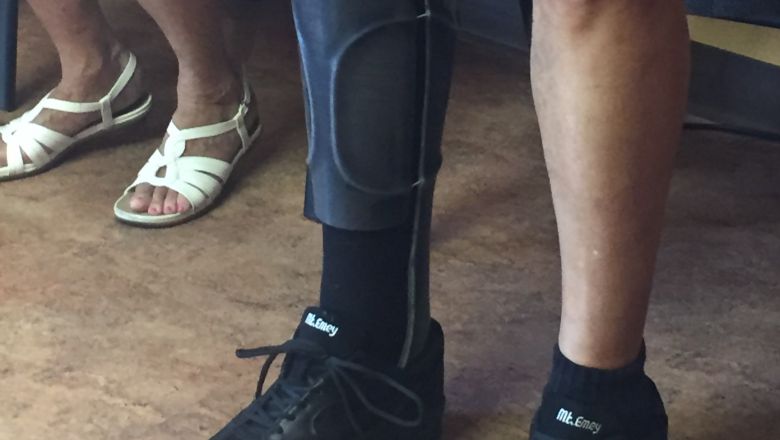 Why Carbon Fiber Braces Are Revolutionizing Orthotics