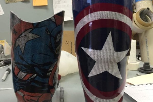 Captain America Leg Braces In The Process Of Being Made For A Child.