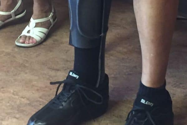 A Close-Up Of A Person Wearing A Prosthetic.