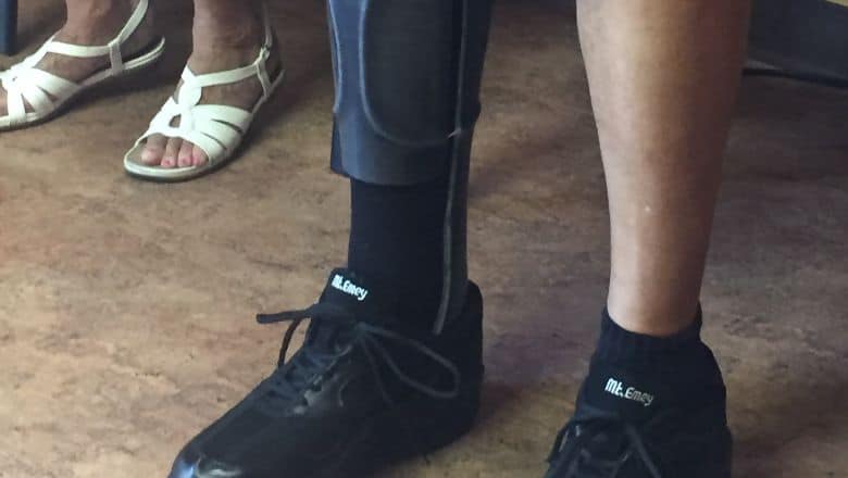 A Close-Up Of A Person Wearing A Prosthetic.
