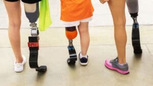 Pediatric Prosthetics For Kids In Las Vegas | Evolve Prosthetics ...