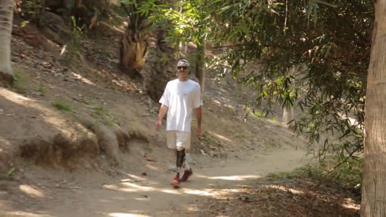 Someone Walking Along A Forest Path, Prosthetic Leg Taking The Next Step.