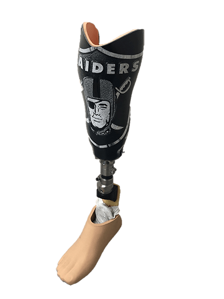 Raider Prosthetic Leg